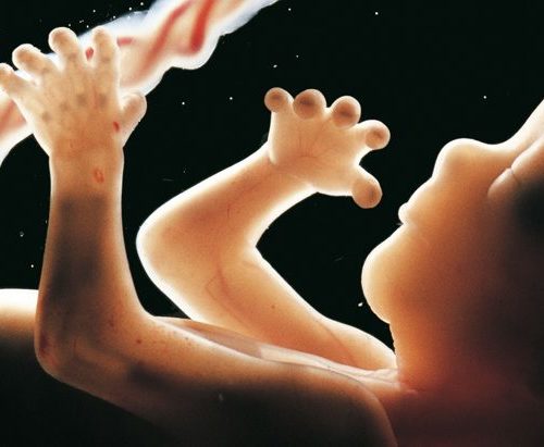 Umbilical cord care