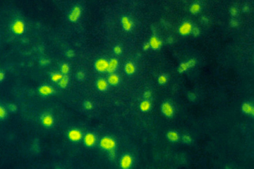 Hib (Haemophilus influenzae type b)