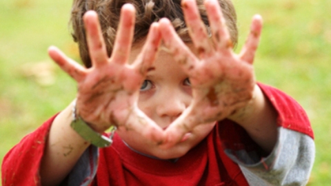HYGIENE AND ALLERGY